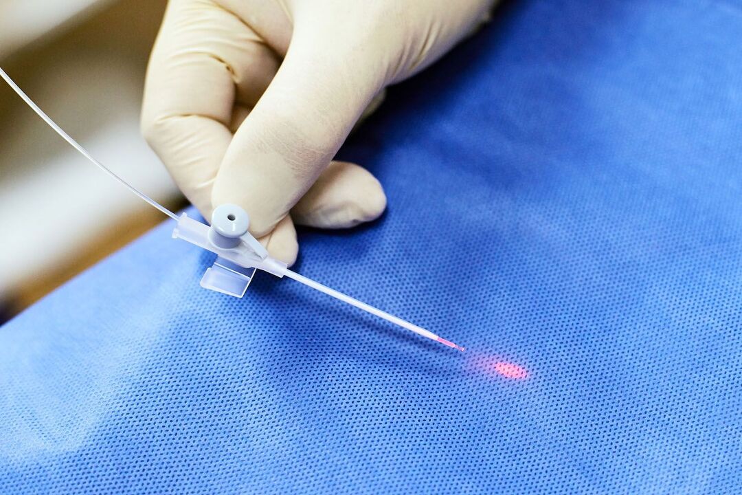 transrektalni uređaj za liječenje prostate