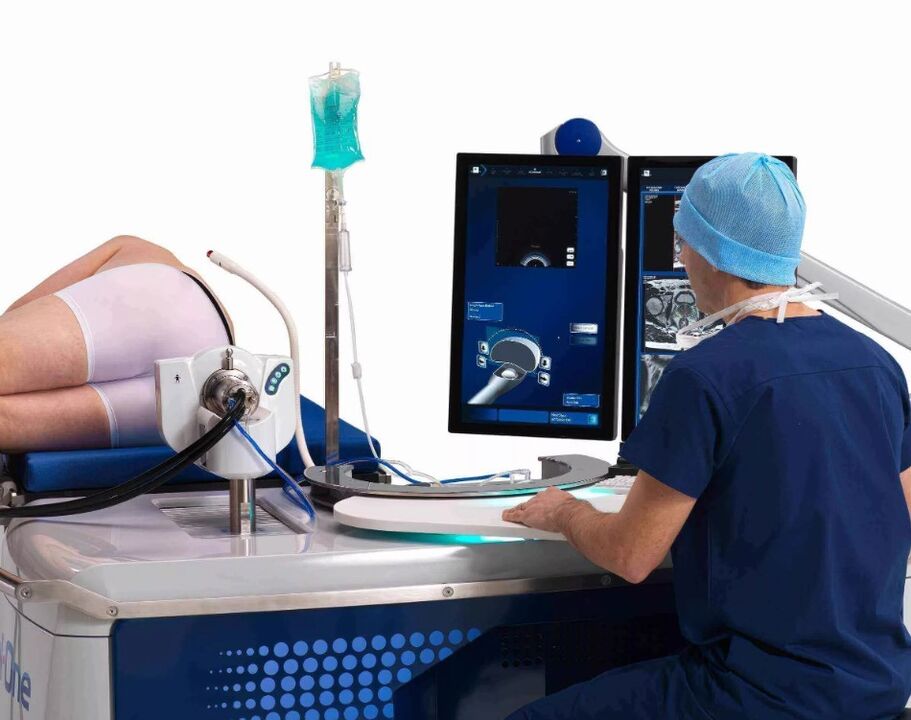 Ultrazvuk ispitivanja prostate